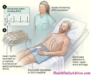 Electrocardiography (ECG or EKG)