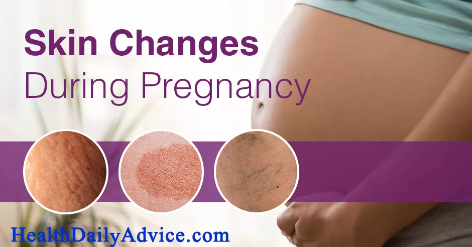 Skin Changes During Pregnancy 