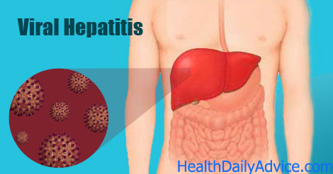  viral-hepatitis