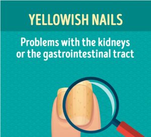 Yellowish Nails