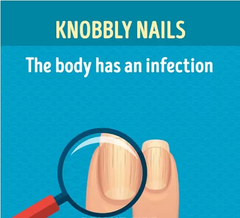 Knobbly Nails