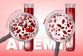What is Anemia and Iron Deficiency
