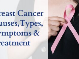 Breast Cancer - Causes, Types, Symptoms and Treatment