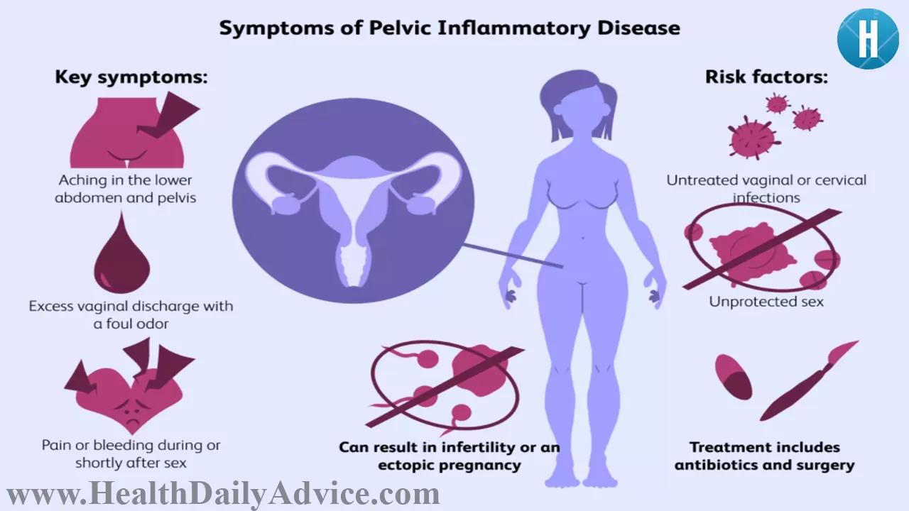 What is Pelvic Inflammatory Disease (PID)