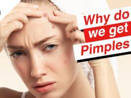 Why do we get pimples?