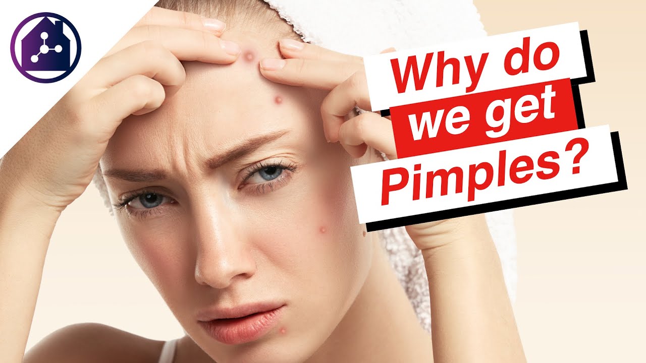 Does Pimples Help Why Do We Get Pimples? Causes, Prevention, and Treatment