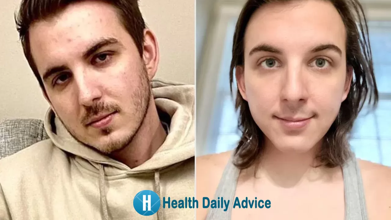 MrBeast’s Chris Tyson on Hormone Replacement Therapy A Journey of Self-Discovery and Empowerment