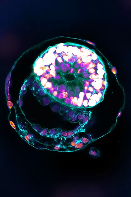 Model of Human Embryo